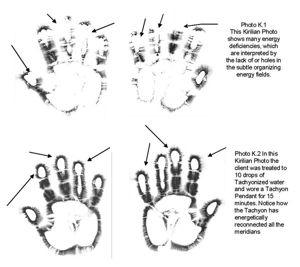 Tachyon and Kirlian Study of Hand 