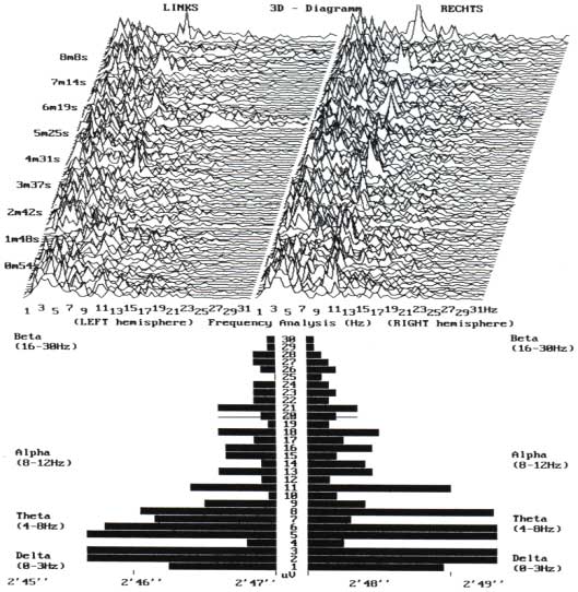 brain-research-tachyon.jpg