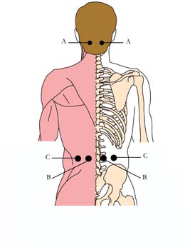 os-2-anti-trauma-cell-points.jpg