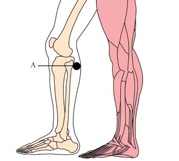 os-27-varicose-veins-cell-points.jpg