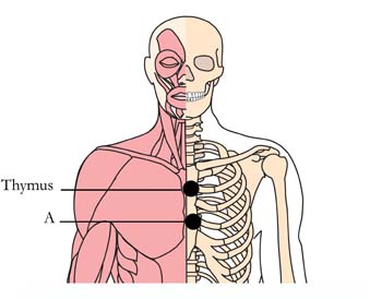 os-lym-lymph-cell-points1.jpg