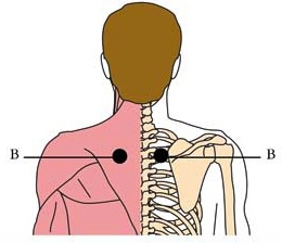 os-lym-lymph-cell-points2.jpg