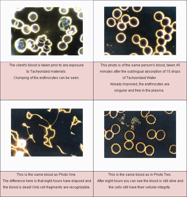 Tachyonized Water and Live Blood Study